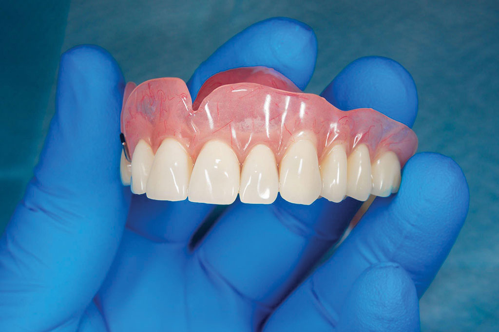 Dentures-Partial-Dentures.jpg